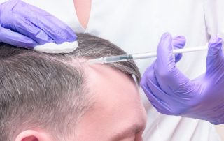 PRP treatment Islamabad