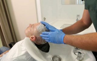 hair transplant Islamabad